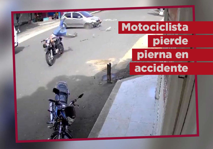 VIDEO: Motociclista iba a exceso de velocidad y pierde la pierna tras rozar con un auto