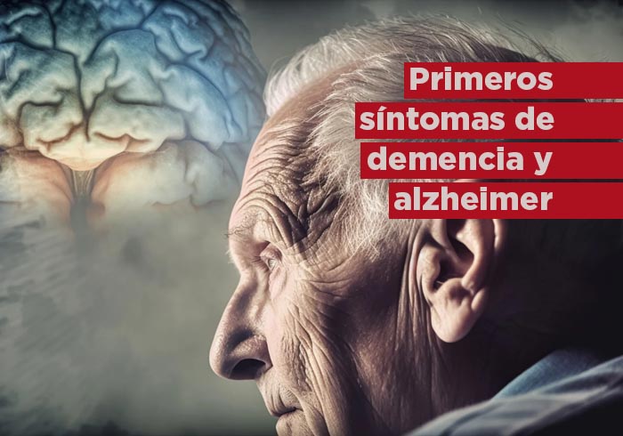 Primeros seis síntomas de demencia y alzheimer a los que debes poner atención