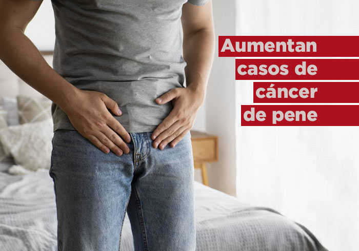 Aumentan casos de cáncer de pene: estos son sus síntomas