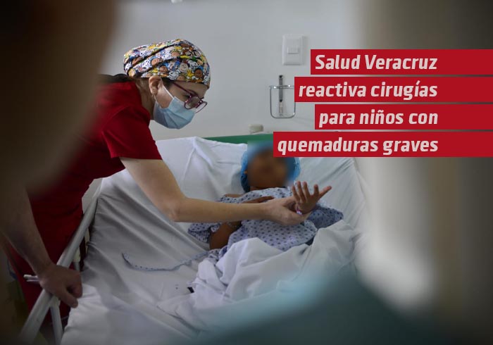 Salud Veracruz reactiva programa de cirugías para niños con quemaduras graves