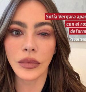 Sofía Vergara aparece con el rostro deformado