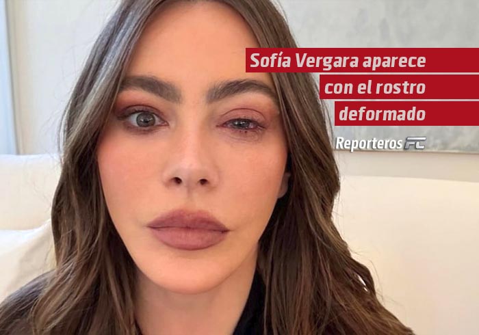 Sofía Vergara aparece con el rostro deformado