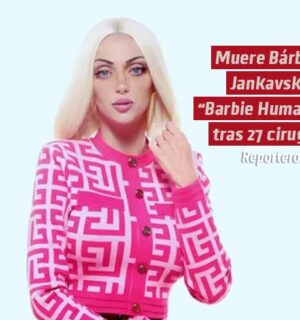 Muere Bárbara Jankavski, la “Barbie Humana” tras 27 cirugías